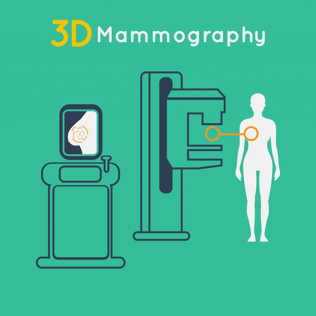 3-D Mammography - The Groundbreaking New Breast Screening Technology ...